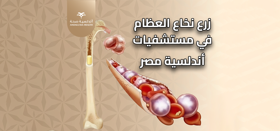 زرع النخاع العظمي في مستشفيات أندلسية، وجهتك لسياحة علاجية متقدمة 