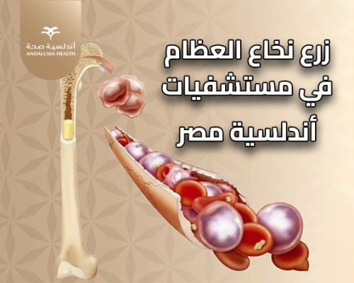 زرع النخاع العظمي في مستشفيات أندلسية، وجهتك لسياحة علاجية متقدمة 